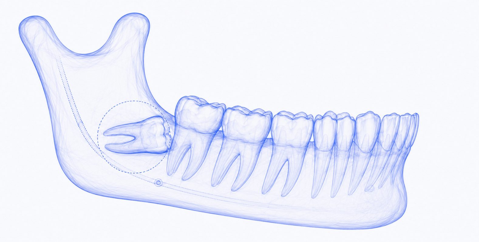 Clinical Endodontics